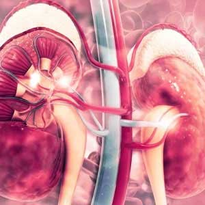 chronic kidney disease